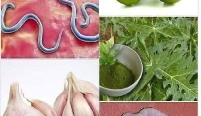9 maneras de la abuela para deshacerse de las lombrices intestinales (rápida y eficazmente)