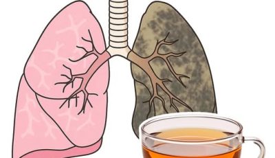 Cómo limpiar tus pulmones, expulsando toda la nicotina, flemas y residuos tóxicos