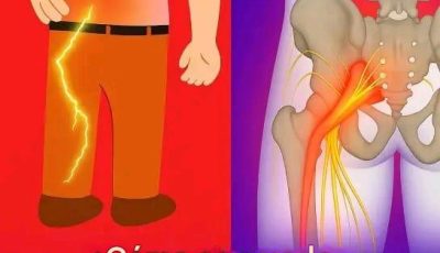 3 ejercicios para aliviar el dolor ciático en la pierna: prácticos y efectivos
