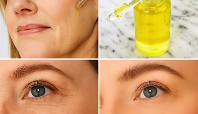 Este aceite antiedad elimina arrugas y manchas de la piel: es uno de los más utilizados en el mundo.