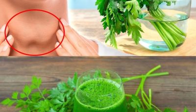 6 sencillos pasos para curar la tiroides de forma natural con perejil y más