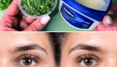 ¿Cómo reducir las arrugas naturalmente con perejil?