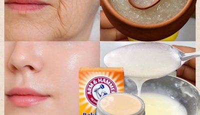 Sábila para una piel blanca, sin manchas, cicatrices o acné