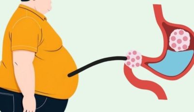 10 alimentos que hacen que tu vientre engorde