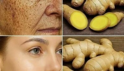 El jengibre es 100 veces más efectivo que el bótox para eliminar arrugas profundas, pecas y decoloración. Tengo que decirte algo para que sigas recibiendo mis recetas… ¡Gracias! 😍 Receta en (comentarios)