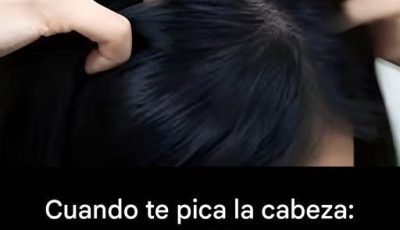 ¿Te pica la cabeza? Estas son las principales causas.