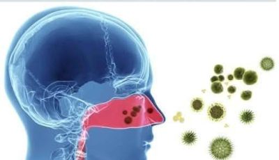 El Remedio Casero que Sorprende: Alivio Natural para Moco, Flema y Rinitis