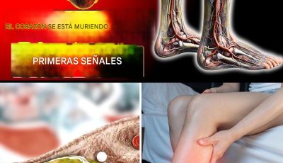 10 señales de advertencia de arterias cardíacas bloqueadas en las piernas y los pies (No ignore estas señales)