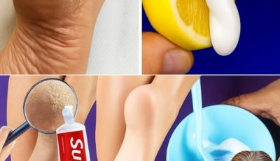 Secretos para unos pies suaves: transforma los talones agrietados con pasta de dientes y limón