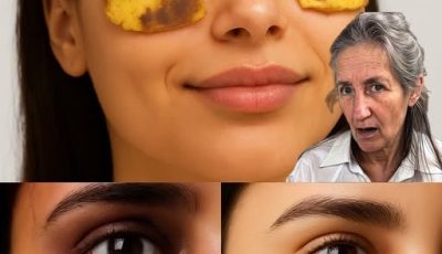 Cáscaras de Plátano: Un Remedio Natural para Combatir las Ojeras