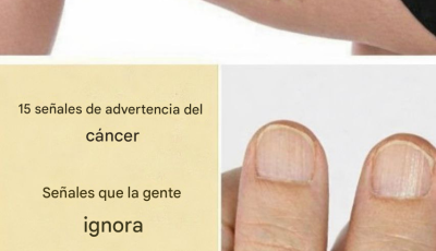 15 señales de advertencia del cáncer que la gente ignora hasta que es demasiado tarde