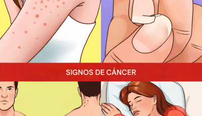 12 señales de alerta temprana de que su cuerpo podría estar desarrollando células cancerosas