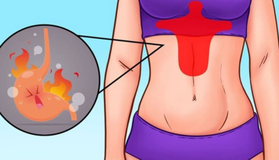 Dolor abdominal: definiciones, tipos y soluciones