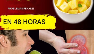 ¿Alto contenido de creatinina? 4 frutas que debes comer para eliminar toxinas por la noche