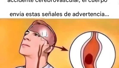 Un mes antes de un AVC, su cuerpo le enviará estas señales de alarma