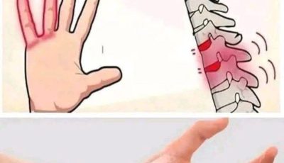 Sensación de hormigueo: ¿Qué es la parestesia?