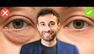 Cómo reducir las bolsas debajo de los ojos y favorecer el drenaje de líquidos de forma natural.