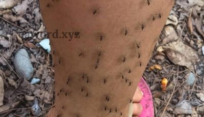 ¿Por qué los mosquitos siempre te escogen a ti? La explicación científica