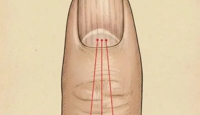 Si tienes rayas en tus uñas significa que tienes can…Ver mas