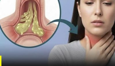 ¿Flemas Constantes en la Garganta y No Sabes Por Qué? Estas Pueden Ser las Causas