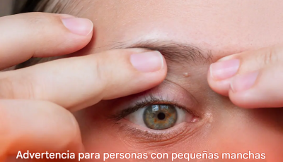 Advertencia para personas con pequeñas manchas blancas que aparecen por todo el cuerpo: un médico explica cómo deshacerse de ellas