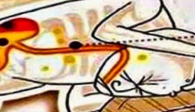 Best Sleeping Position for Acid Reflux and Heartburn