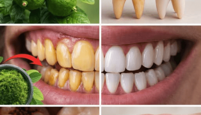 Most Seniors Over 60 Don’t Know This Simple Evening Rinse for Healthier Gums